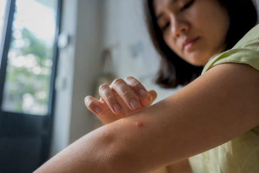 Hand pausing above an itchy mosquito bite