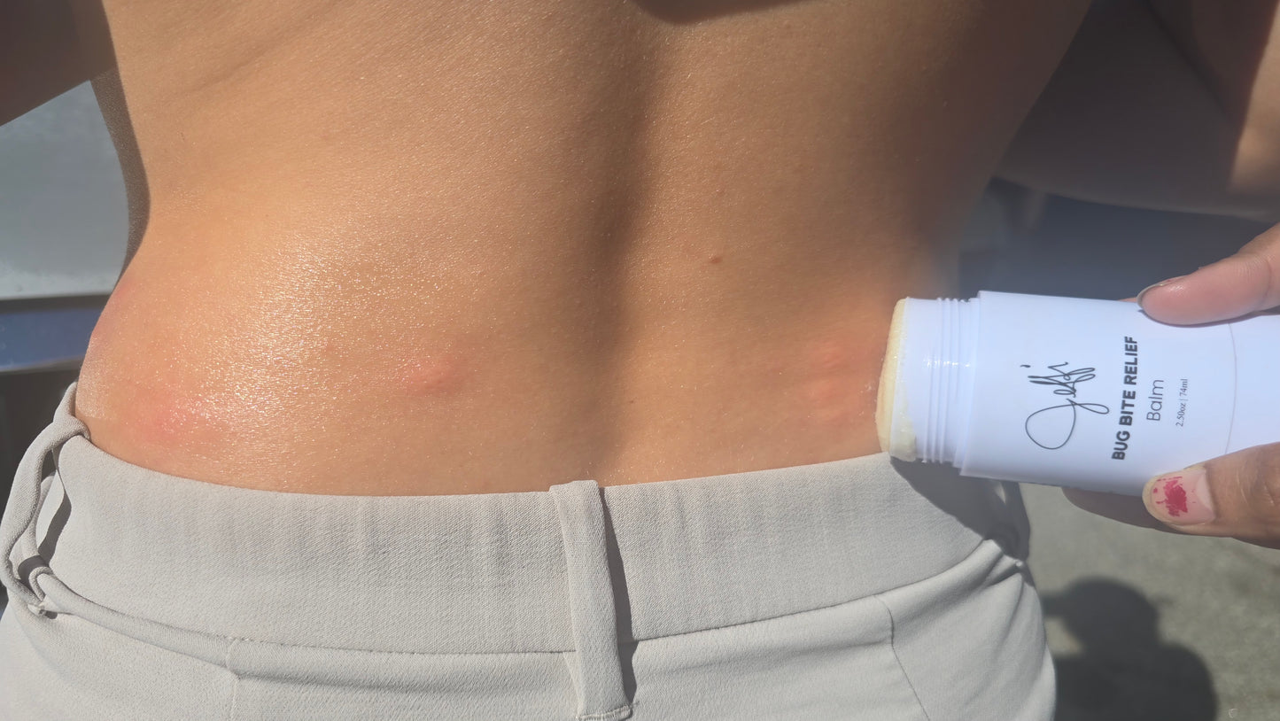 Bug Bite Relief Balm