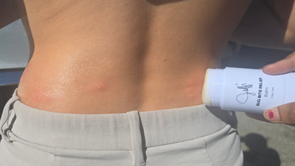 Bug Bite Relief Balm