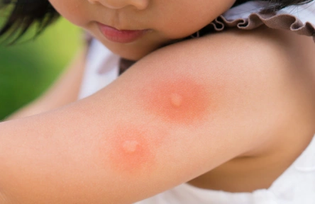 Jeffi-home 26 Best Mosquito Repellent Without Chemicals